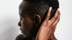 How to Take Care of Your Natural Hair If You Have Scalp Eczema